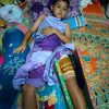 Anak Berusia 11 Tahun di Desa Kuala Alam Butuh Uluran Tangan, RK Mengalami Patah Tulang Paha Akibat Laka Lantas