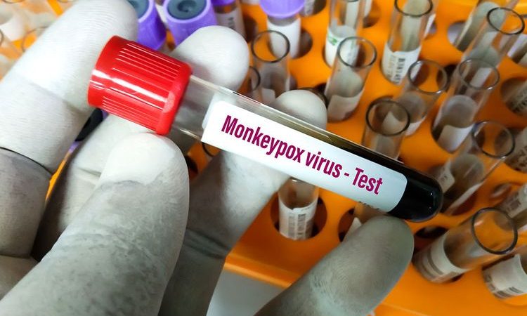 Cacar Monyet Masuk ke Indonesia, Kadiskes Riau Minta Kabupaten Kota Segera Lakukan Pencegahan
