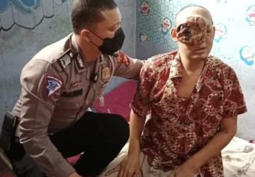 Tumor Ganas Hampir Menutup Semua Wajahnya, Polisi Bantu Carikan Pendonasi