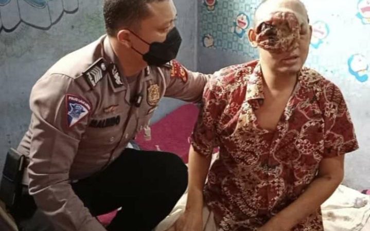 Tumor Ganas Hampir Menutup Semua Wajahnya, Polisi Bantu Carikan Pendonasi