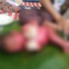 Bayi Lahir Kondisi Kulit Mengering dan Memerah di Desa Baru Dirujuk ke RS Umum Bangkinang