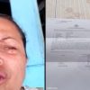 Diduga Lakukan Pengeroyokan, Yeni Minta Pelaku Segera Ditangkap