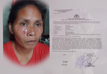 Korban Penganiayaan Suani Zai, Berharap Agar Pelaku di Tangkap