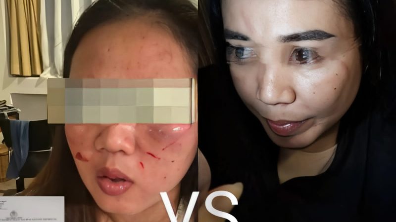 Honorer DPRD Tanggamus Saling Lapor Polisi, Terkait Kasus Penganiayaan