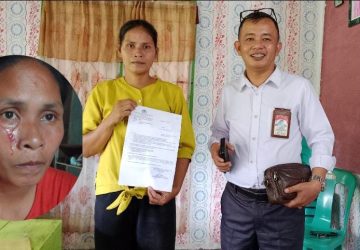 Mantap! Kasus Dugaan Penganiayaan Seorang Ibu Rumah Tangga Naik ke Penyidikan