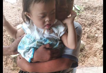 Penyakit Menimpa Dua Balita di Dusun Gunung Haji: Keluarga Memohon Bantuan dari Pemerintah