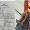 Wartawan Jawa Pos Radar Situbondo Jadi Korban Dugaan Kekerasan saat Liput Demo Bupati