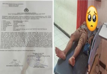 Wartawan Jawa Pos Radar Situbondo Jadi Korban Dugaan Kekerasan saat Liput Demo Bupati