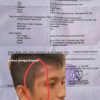 David Real Grace Waruwu dan Keluarga Minta Kapolres Nias Agar Terduga Pelaku Penganiayaan Segera di Tangkap