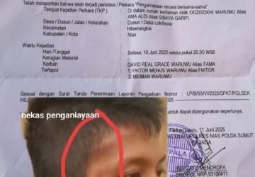 David Real Grace Waruwu dan Keluarga Minta Kapolres Nias Agar Terduga Pelaku Penganiayaan Segera di Tangkap